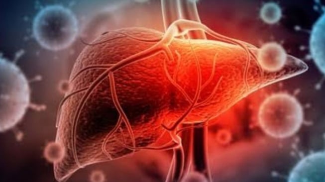Ilustrasi penyakit Hepatitis. [ANTARA/Shutterstock]