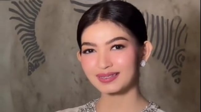 Selvi Ananda pakai behel. [Tiktok/antoniusanung]