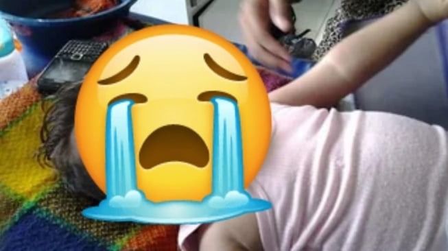 tubuh bayi di Ogan Komering Ilir (OKI) Sumsel yang bengkak setelah diinfus