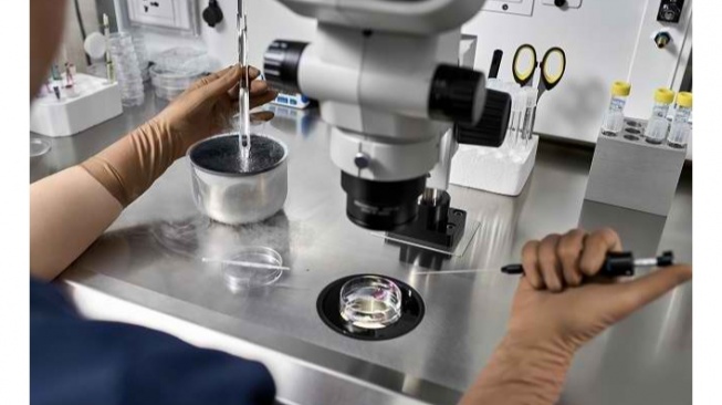 Prosedur egg freezing (alodokter)