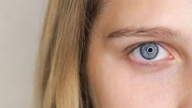 Kolesterol tinggi dapat ditandai dengan kemunculan corneal arcus atau cincin berwarna abu-abu atau putih yang mengelilingi bagian luar kornea mata (Freepik)