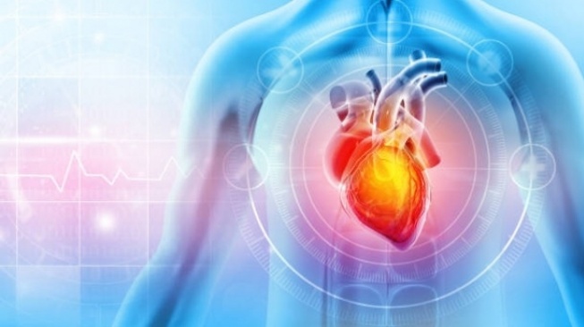Mengenal Zero Fluoroscopy, Pilihan Baru Tindakan Jantung
