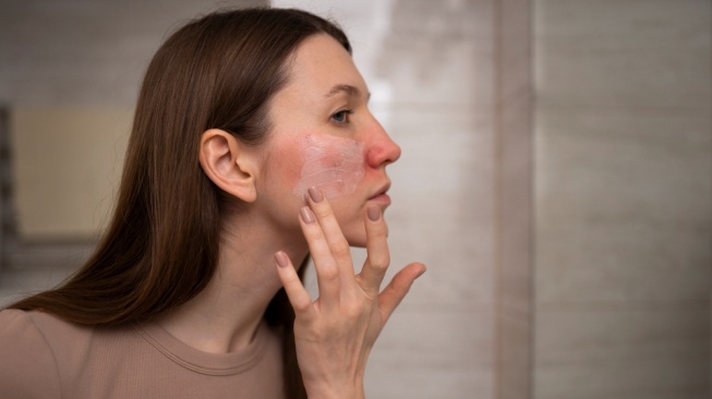 Rangkaian Skincare Malam Viva untuk Kulit Bruntusan, Wajah Kembali Mulus dan Cerah