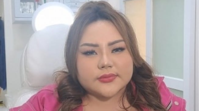 3 Hari Usai Operasi Bariatrik, Lisa Mariana Ngaku Berat Badannya Sudah Turun 5 Kilogram