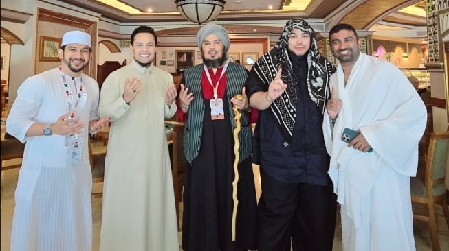 Ivan Gunawan bagikan pengalamannya kepalanya yang botak setelah tahalul (Instagram)