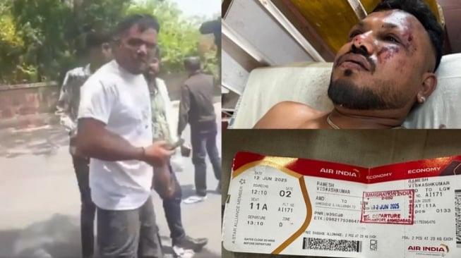 Sulit Dipercaya, Kesaksian Ramesh Satu-satunya Korban Selamat Kecelakaan Pesawat Air India