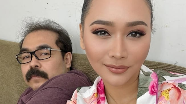 Suami Masih Terbaring Lemah di Rumah Sakit, Mata Inul Daratista Bengkak Akibat Menangis Terus