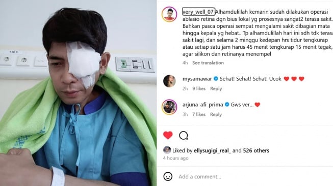 Veri AFI mengungkap kondisi mata kirinya yang mengalami ablasio retina. [Instagram]