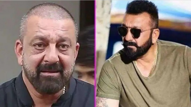 Sanjay Dutt menjadi salah satu aktor Bollywood yang melakukan transplantasi rambut. [Instagram]