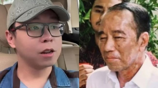 dr Richard Lee Tanggapi Masalah Kulit yang Dialami Jokowi: Jangan Dibawa ke Dukun