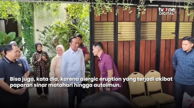 Richard Lee Ikut 'Bedah' Kondisi Kesehatan Jokowi, Sebut 3 Kemungkinan Penyebabnya. [Instagram]