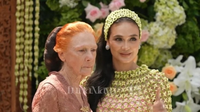 Luna Maya Bangga Pakai BPJS, Biaya Operasi Ibunda Rp 120 Juta Ditanggung