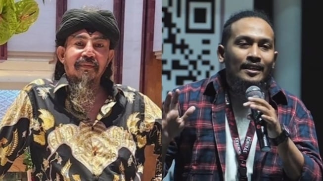 Kemlu Bantah Limbad Ditahan Gara-gara Gigi Taring, Abdur Arsyad Bohong?