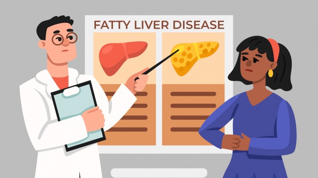 ilustrasi fatty liver (freepik)