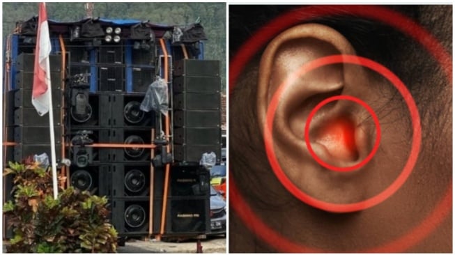 Gengsi Hajatan 'Sound Horeg' Berujung Petaka, Warga Ramai-Ramai Berobat ke Poli THT