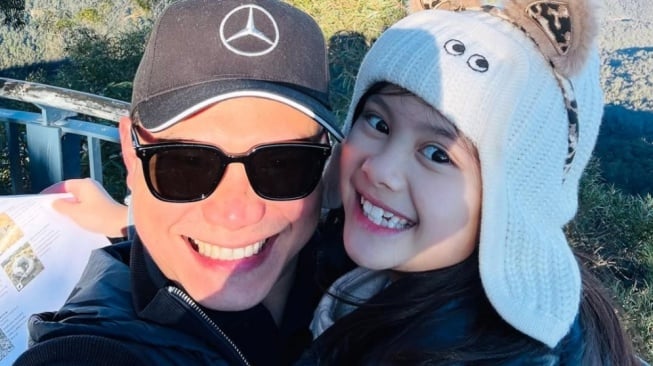 Unggahan Vicky Kharisma Jadi Isyarat Jelas Move On dari Acha Septriasa