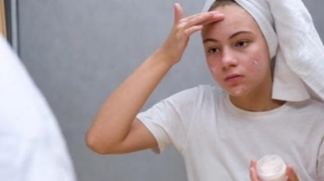 4 Pelembab Gel Berbahan Panthenol untuk Kulit Berminyak dan Redakan Redness