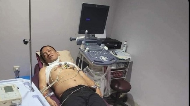 Heboh usai OTT KPK, Muncul Foto Wamenaker Immanuel Ebenezer Lemas Terpasang Alat EKG, Benarkah?