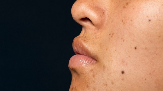 5 Rekomendasi Moisturizer untuk Flek Hitam Selain Wardah, Harga Murah Mulai Rp23 Ribu