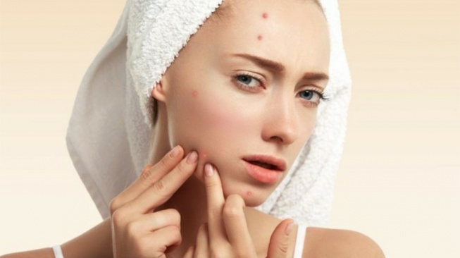 Aman Dipakai Tiap Hari! Ini 5 Daun Herbal yang Bisa Bikin Jerawat Minggat