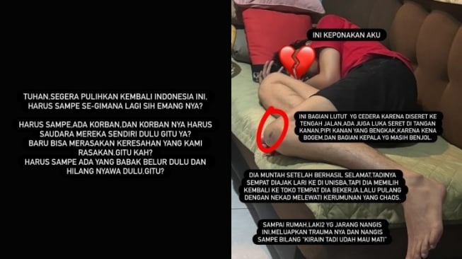Keponakan Chika Jessica Jadi Korban Salah Pukul Oknum Polisi saat Demo di Bandung (Instagram/@chikajessica88)