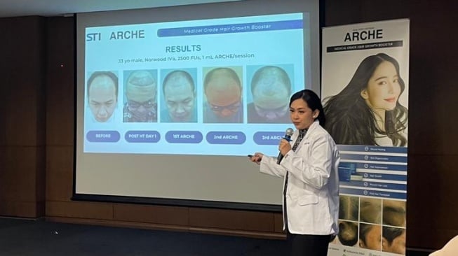 Terobosan Baru Penunjang Transplantasi Rambut, Percepat Pertumbuhan Folikel (Dok. Istimewa)
