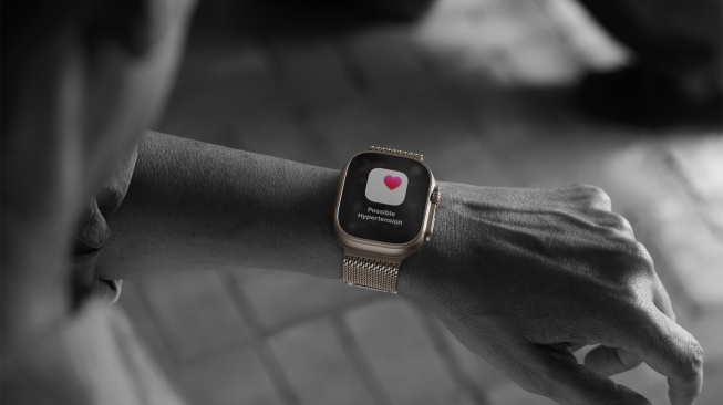 Apple Watch Ultra 3. [Apple]