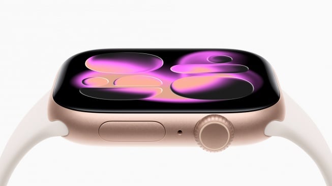 Apple Watch Series 11. [Apple]
