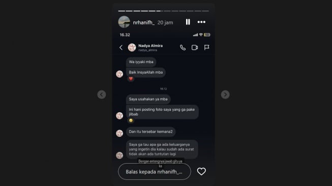 Reaksi Nadya Almira soal kasus tabrak larinya yang diungkit lagi (Instagram/@hany)