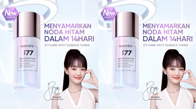 Toner untuk mengatasi flek hitam. (Shopee)