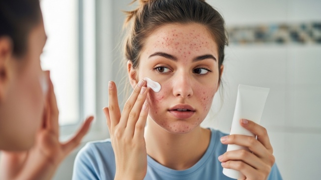 5 Sunscreen Favorit 2025 untuk Kulit Kering dan Berjerawat: Kulit Lembap Tanpa Bikin Breakout Parah!