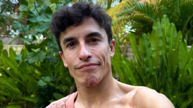 Kondisi Terbaru Marc Marquez Usai Patah Tulang Bahu Kanan di MotoGP Mandalika [@marcmarquez93]