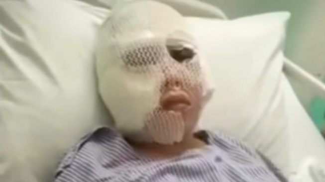 Uya Kuya Ikut Turun Tangan, Kasus Penyiksaan Brutal WNI di Malaysia Libatkan Tiga WNI
