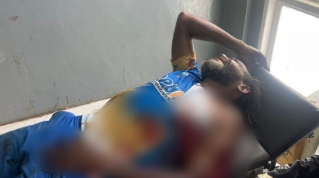 Korban Berjatuhan di Nabire, OPM Tembak Warga Sipil
