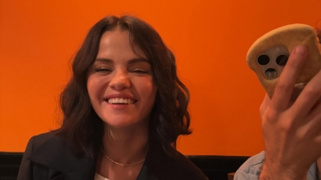 Wajah Berubah Drastis, Selena Gomez Punya Riwayat Penyakit Ini