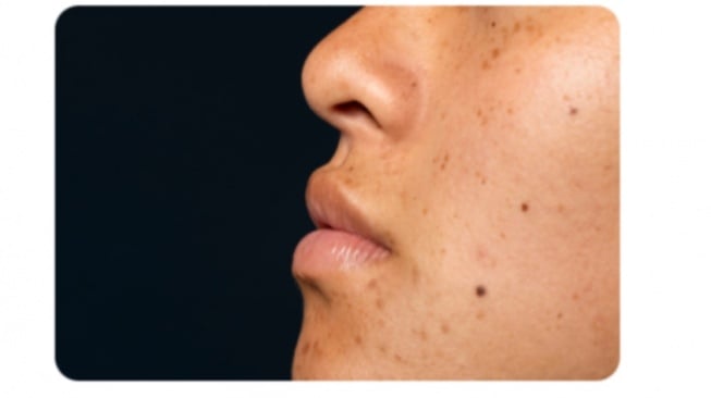 6 Cream Paling Ampuh Penghilang Flek Hitam untuk Usia 40 Tahun Keatas, Harga Rp40 Ribuan