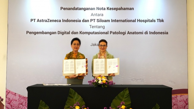 Pertama di Indonesia: Terobosan Berbasis AI untuk Tingkatkan Akurasi Diagnosis Kanker Payudara