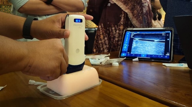 Sakit dan Trauma Akibat Infus Gagal? USG Jadi Solusi Aman Akses Pembuluh Darah!