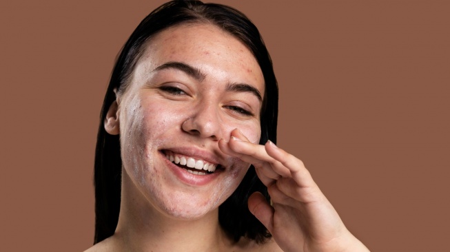 5 Sunscreen Tone Up Non Comedogenic Terbaik untuk Kulit Berjerawat