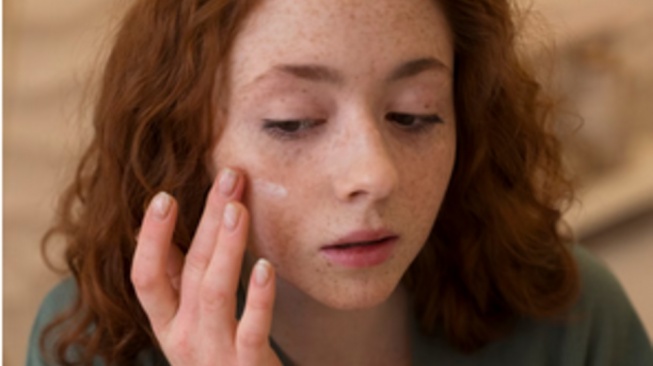 5 Sunscreen Ringan untuk Mencegah Breakout, Cocok bagi Pemilik Kulit Berjerawat