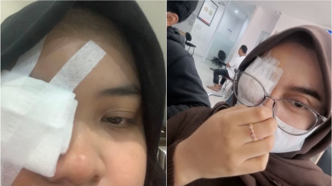 Konsumen Pinkflash yang alami efek samping penggunaan eyeshadow berbahaya (TikTok/Pinkflash)