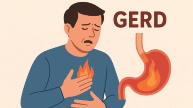5 Buah Tinggi Alkali yang Aman Dikonsumsi Penderita GERD, Bisa Mengatasi Heartburn