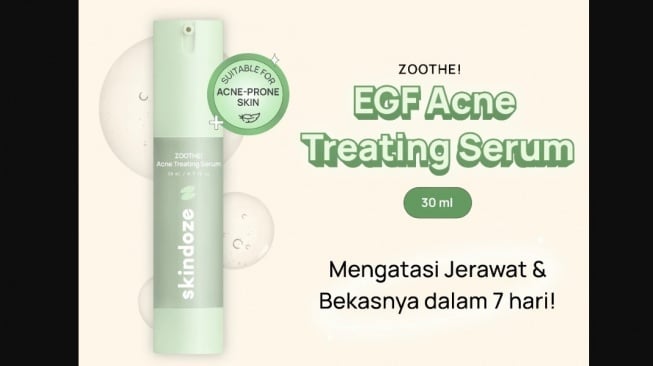 Serum dengan kandungan Azeclair dari Skindoze (Shopee Skindoze)