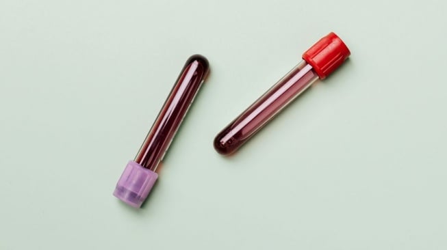 Ilustrasi golongan darah (Pexels/Karola G)