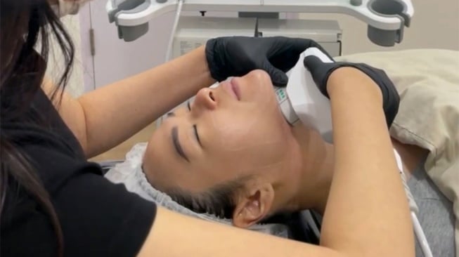 Era Baru Anti-Aging, Ini Dia Teknologi Lifting Tanpa Bedah Setara Face Lift