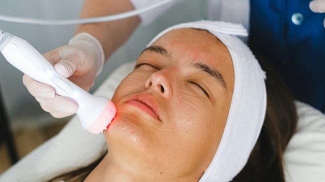 Bukan Lagi Jerawatan, Remaja Kini Datang ke Klinik Agar Wajah Lebih Tirus