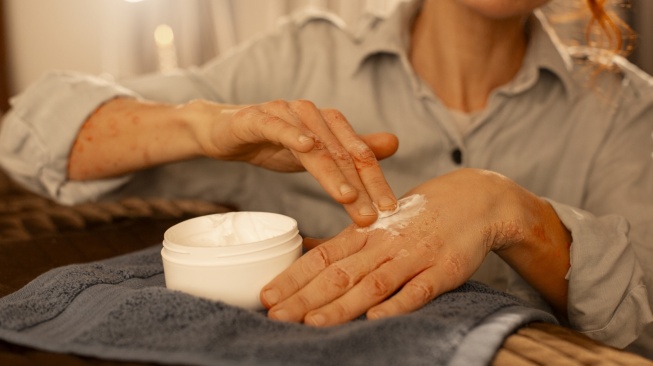 6 Rekomendasi Body Lotion dengan Anti-Aging untuk Mencegah Tanda Penuaan