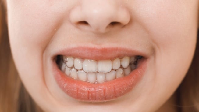 Gigi Goyang Saat Dewasa? Waspada! Ini Bukan Sekadar Tanda Biasa, Tapi Peringatan Serius dari Tubuh