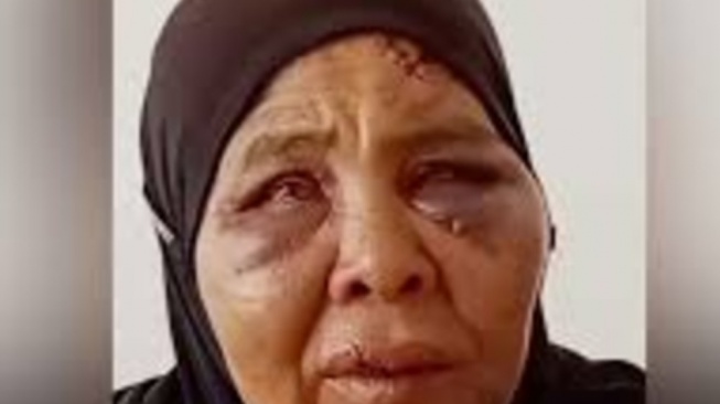 Pelaku Penganiaya Nenek yang Tolak Tambang Ilegal di Pasaman Ditangkap, Ini Kata Wagub Sumbar