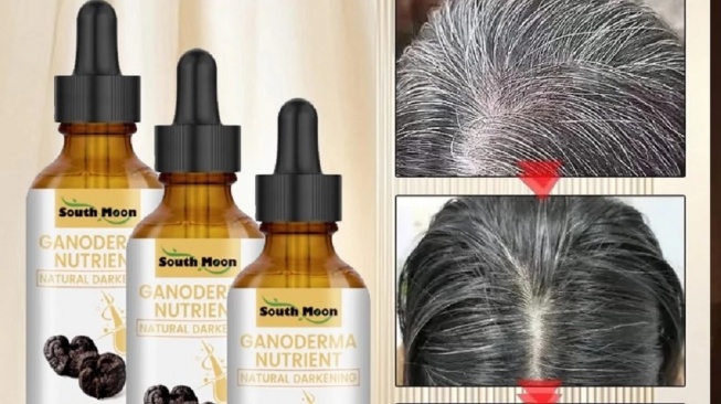 Minyak Esensial Rambut Hitam (Shopee/Harmolytix Official Store)